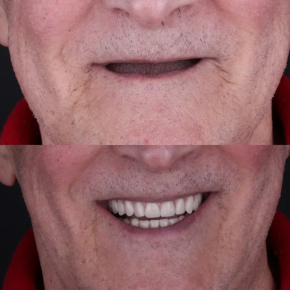 YouTube-проект "Нове життя"