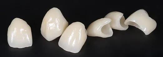 Протезирование всей челюсти на 4-х, 6-х или 8-х имплантатах