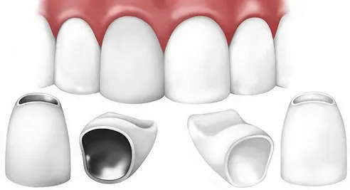 Циркониевые коронки