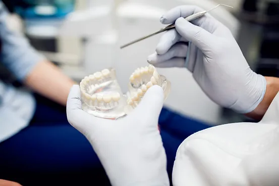 Макет зубів, зліпок зубів