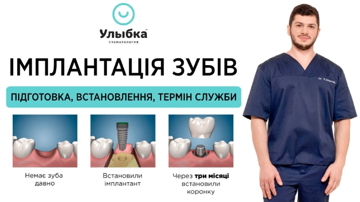Імплантація зубів - етапи встановлення, термін служби зубних імплантів. Одеса, стоматологія Brillant Dental