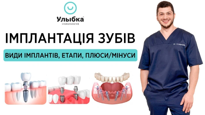 Імплантація Зубів - види імплантів, етапи встановлення, плюси та мінуси. Одеса, стоматологія Brillant Dental