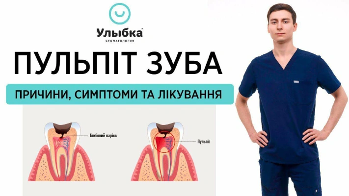 ПУЛЬПІТ ЗУБА: симптоми, причини та лікування пульпіту | Одеса, стоматологія Brillant Dental