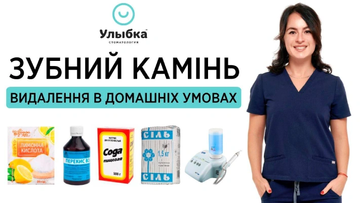ЗУБНИЙ КАМІНЬ: видалення в домашніх умовах чи в стоматології? - Одеса, стоматологія Brillant Dental