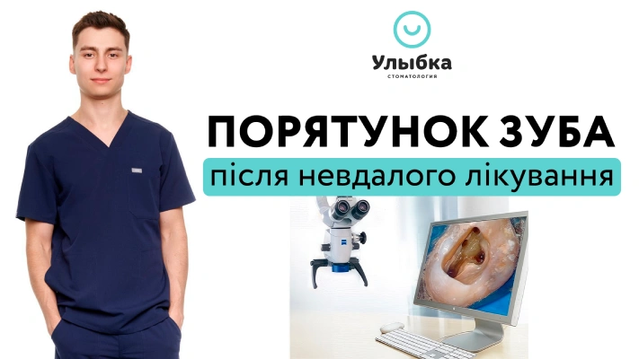 Порятунок зуба після невдалого лікування. Клінічний Випадок. Одеса. Стоматологія Brillant Dental