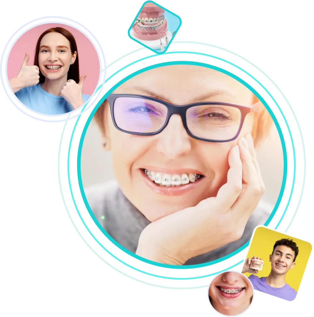 Брекети в Одесі