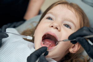 кариес молочных зубов