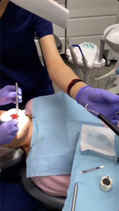 Профессиональная чистка зубов в Одессе