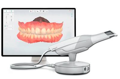 3Shape цифрове сканування в Одесі